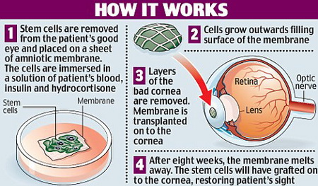 stems-cells-grown-to-restore-eyesight